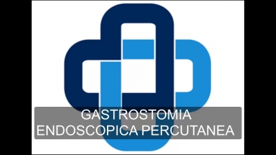 Gastrostom&iacute;a percut&aacute;nea endosc&oacute;pica